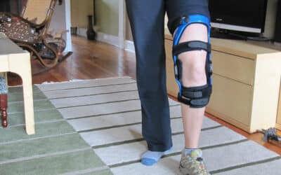 Tips to Handle Skin Care and Prevent Skin Irritation from Knee Brace