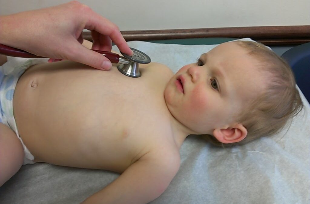 How to Deal With Your Child's Pectus Carinatum Condition - Align Clinic