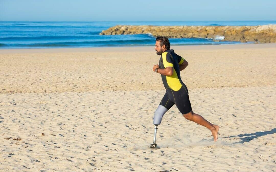 What to Expect From a BKA Prosthesis Rehabilitation Program