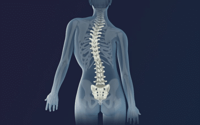 Why You Need Early Diagnosis And Intervention For Scoliosis