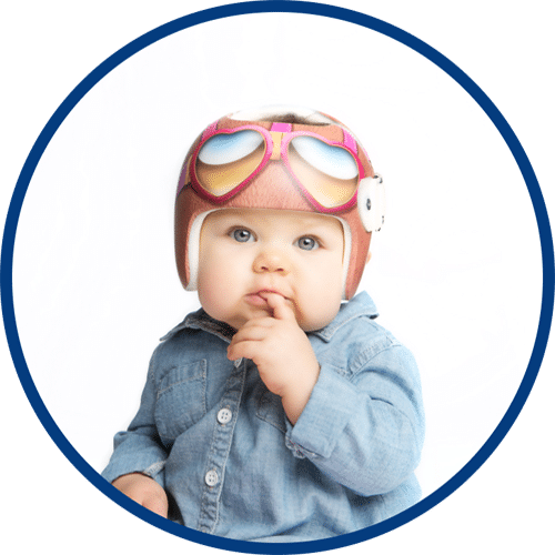 Baby Helmet Therapy